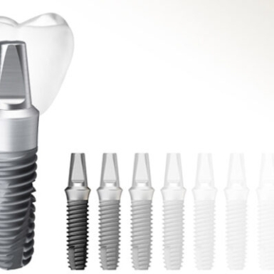 Implant Hiossen