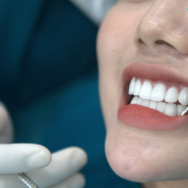 Phục hình răng sứ thẩm mỹ