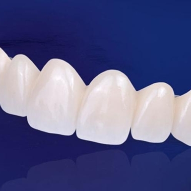Răng sứ Emax